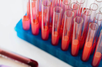 Naukowcy odkryli nowe powiązania między grupą krwi a ryzykiem niektórych chorób.