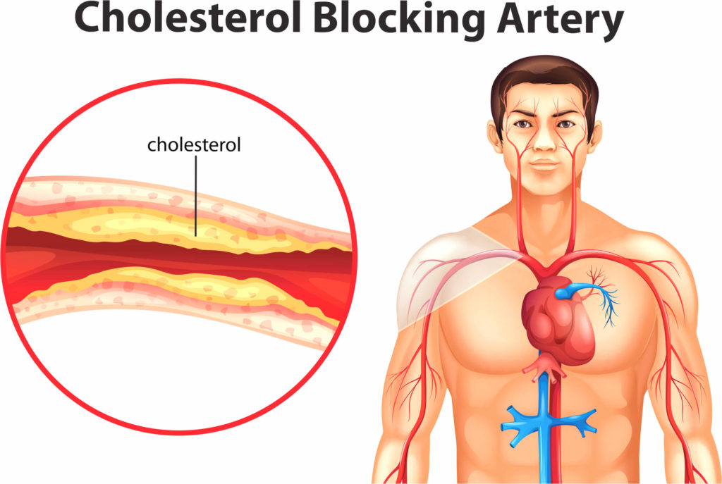 Cholesterol - funkcje, źródła, frakcje, stężenie