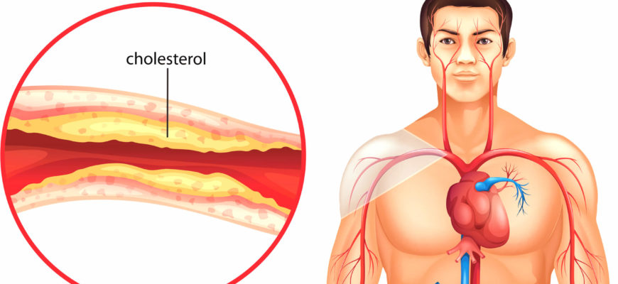 Cholesterol - funkcje, źródła, frakcje, stężenie